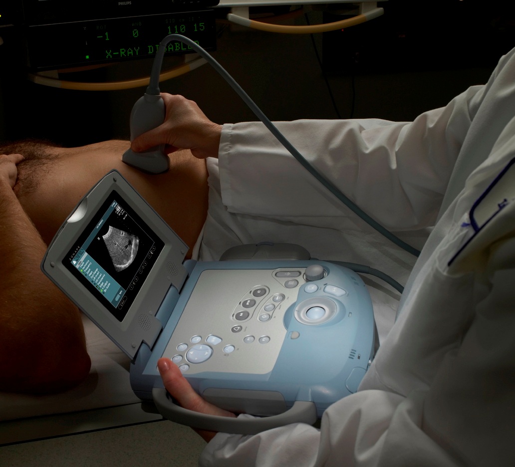 Zonare Ultrasound